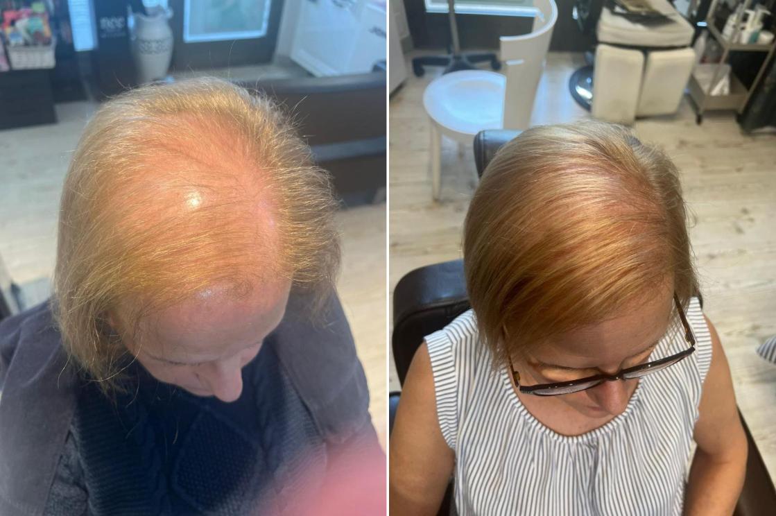 coldhair-avant:apres-C